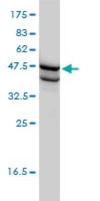 Western Blot: SSB Antibody (1D6-H5) [H00006741-M01]