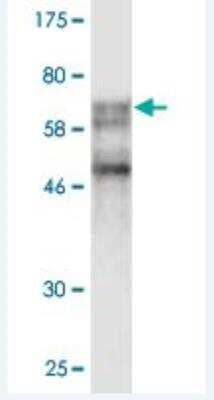 Western Blot: SSB Antibody (3H7-F7) [H00006741-M02]