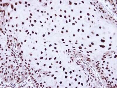 Immunohistochemistry-Paraffin: SSB Antibody [NBP1-33549]