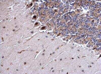 Immunohistochemistry-Paraffin: SSB Antibody [NBP1-33549]