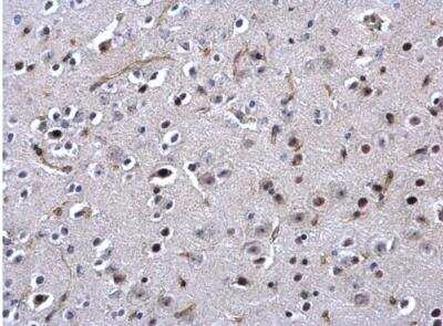 Immunohistochemistry-Paraffin: SSB Antibody [NBP1-33549]