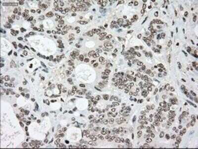 Immunohistochemistry: SSB Antibody (OTI2C8) - Azide and BSA Free [NBP2-74356]