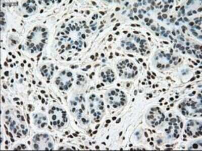 Immunohistochemistry: SSB Antibody (OTI2C8) - Azide and BSA Free [NBP2-74356]
