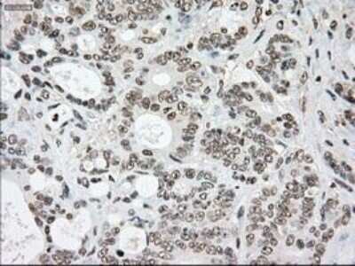 Immunohistochemistry: SSB Antibody (OTI2C8) - Azide and BSA Free [NBP2-74356]