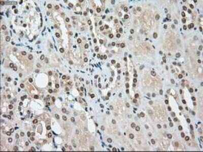 Immunohistochemistry: SSB Antibody (OTI2C8) - Azide and BSA Free [NBP2-74356]