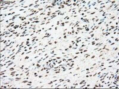 Immunohistochemistry: SSB Antibody (OTI2C8) - Azide and BSA Free [NBP2-74356]