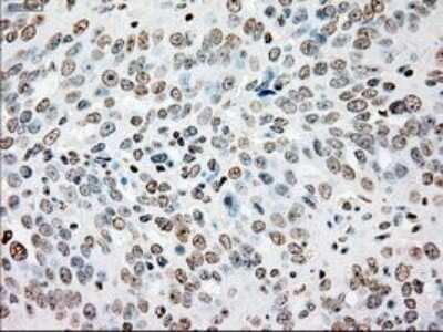 Immunohistochemistry: SSB Antibody (OTI2C8) - Azide and BSA Free [NBP2-74356]