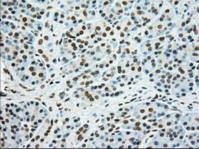 Immunohistochemistry: SSB Antibody (OTI2C8) - Azide and BSA Free [NBP2-74356]
