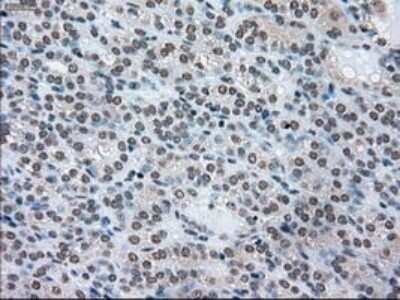 Immunohistochemistry: SSB Antibody (OTI2C8) - Azide and BSA Free [NBP2-74356]