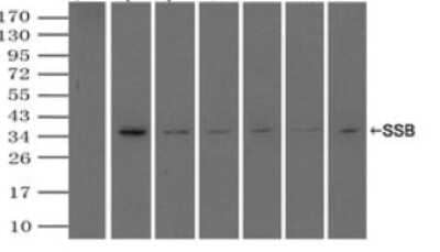 Immunoprecipitation: SSB Antibody (OTI2C8) - Azide and BSA Free [NBP2-74356]