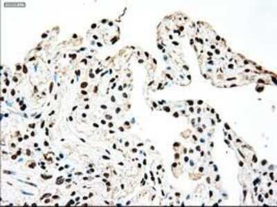 Immunohistochemistry-Paraffin: SSB Antibody (OTI2C8) [NBP1-48002]