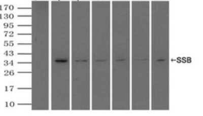 Immunoprecipitation: SSB Antibody (OTI2C8) [NBP1-48002]