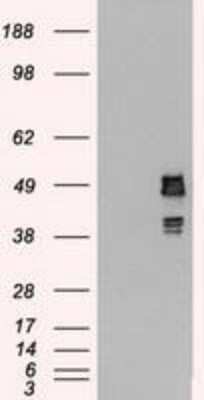 Western Blot: SSB Antibody (OTI2C8) [NBP1-48002]