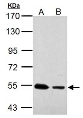 Western Blot: SSB Antibody [NBP1-33549]