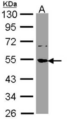 Western Blot: SSB Antibody [NBP1-33549]