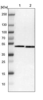 Western Blot: SSB Antibody [NBP1-82851]