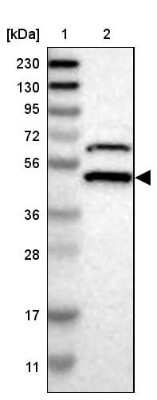 Western Blot: SSB Antibody [NBP1-82851]