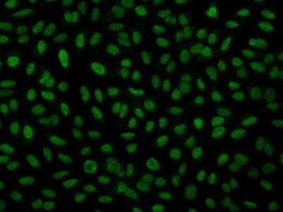 Immunocytochemistry/ Immunofluorescence: SSBIP1/SOSS-C Antibody [NBP2-98143]