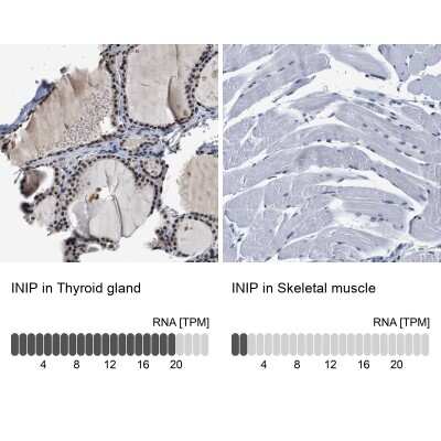 Immunohistochemistry-Paraffin: SSBIP1/SOSS-C Antibody [NBP1-81682]