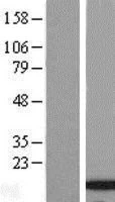 Western Blot: SSBIP1/SOSS-C Overexpression Lysate [NBL1-08602]