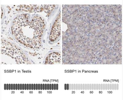 Immunohistochemistry-Paraffin: SSBP1 Antibody [NBP1-80720]