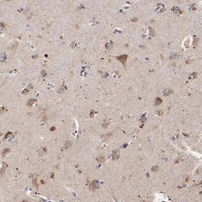 Immunohistochemistry-Paraffin: SSBP1 Antibody [NBP1-80720]