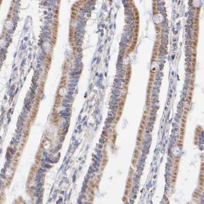 Immunohistochemistry-Paraffin: SSBP1 Antibody [NBP1-80720]