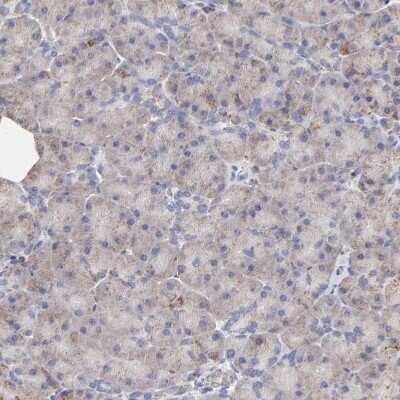 Immunohistochemistry-Paraffin: SSBP1 Antibody [NBP1-80720]