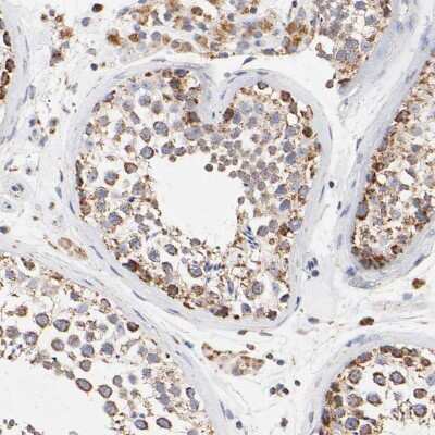 Immunohistochemistry-Paraffin: SSBP1 Antibody [NBP1-80720]