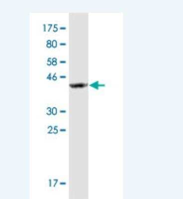 Western Blot: SSBP2 Antibody (2E7) [H00023635-M10]