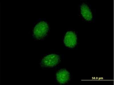 Immunocytochemistry/ Immunofluorescence: SSBP2 Antibody [H00023635-B01P]