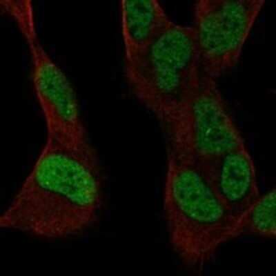 Immunocytochemistry/ Immunofluorescence: SSBP2 Antibody [NBP3-17937]