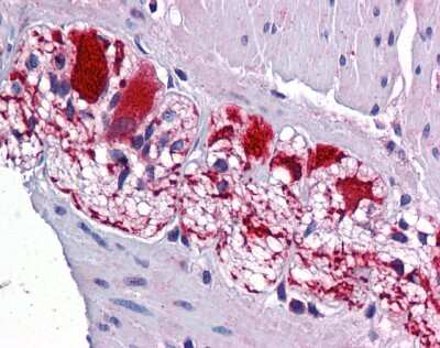 Immunohistochemistry: SSBP2 Antibody [NBP3-10915]