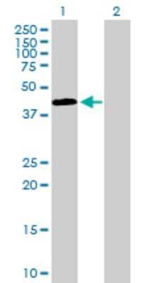 Western Blot: SSBP2 Antibody [H00023635-B01P]