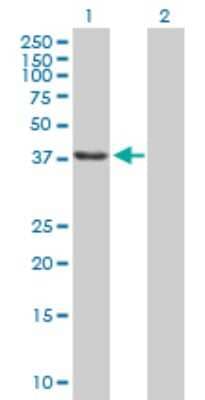 Western Blot: SSBP2 Antibody [H00023635-B02P]