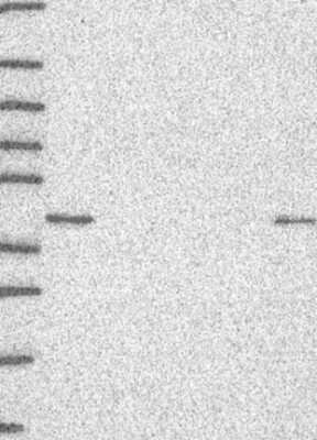 Western Blot: SSBP2 Antibody [NBP3-17937]