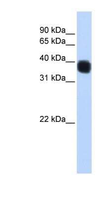 Western Blot: SSBP3 Antibody [NBP1-56591]