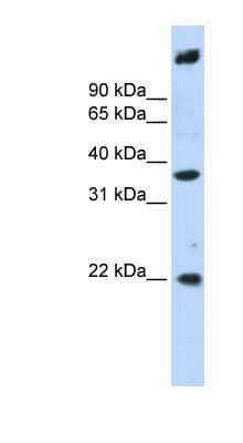 Western Blot: SSBP3 Antibody [NBP1-56606]