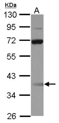 Western Blot: SSBP3 Antibody [NBP2-20487]