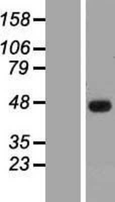 Western Blot: SSBP3 Overexpression Lysate [NBL1-16467]