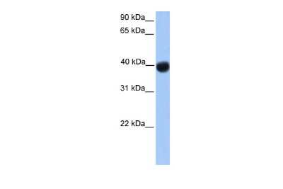 Western Blot: SSBP4 Antibody [NBP2-84283]