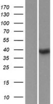 Western Blot: SSBP4 Overexpression Lysate [NBP2-05985]