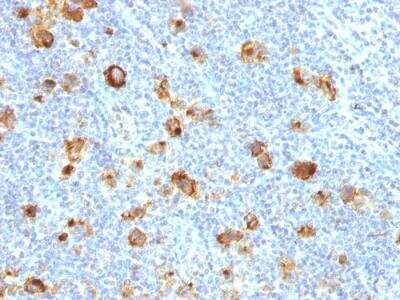 Immunohistochemistry-Paraffin: SSEA-1 Antibody (FUT4/1478R) - Azide and BSA Free [NBP2-49879]