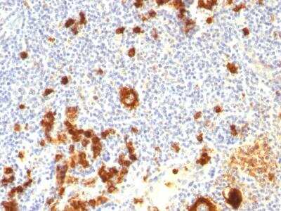 Immunohistochemistry-Paraffin: SSEA-1 Antibody (FUT4/815 + BRA-4F1) - IHC-Prediluted [NBP2-48448]