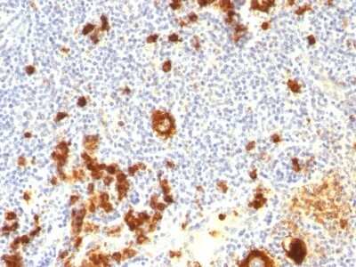 Immunohistochemistry-Paraffin: SSEA-1 Antibody (FUT4/815 + BRA-4F1) [NBP2-45306]