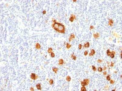 Immunohistochemistry-Paraffin: SSEA-1 Antibody (FUT4/815) - IHC-Prediluted [NBP2-48370]