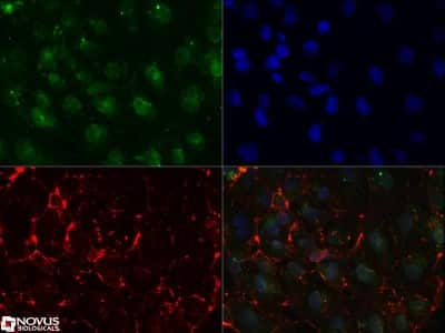 Immunocytochemistry/ Immunofluorescence: SSEA-1 Antibody (MC-480) [NB100-1831]