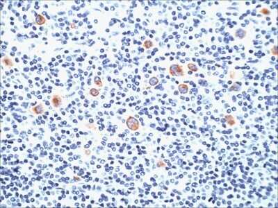 Immunohistochemistry-Paraffin: SSEA-1 Antibody (SPM490) [NBP2-45305]