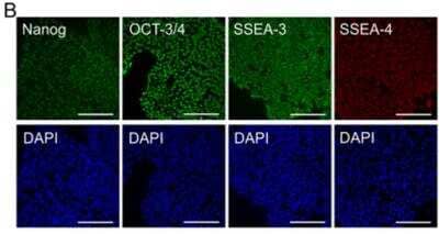 Immunocytochemistry/ Immunofluorescence: SSEA-3 Antibody (MC-631) [NB100-1832]