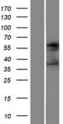 Western Blot: SSEA-1 Overexpression Lysate [NBP2-10793]